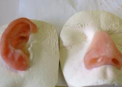 prothèse faciale Charleroi prothèse faciale Charleroi
