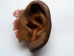 prothèse d\'oreille Charleroi prothèse d\'oreille Charleroi