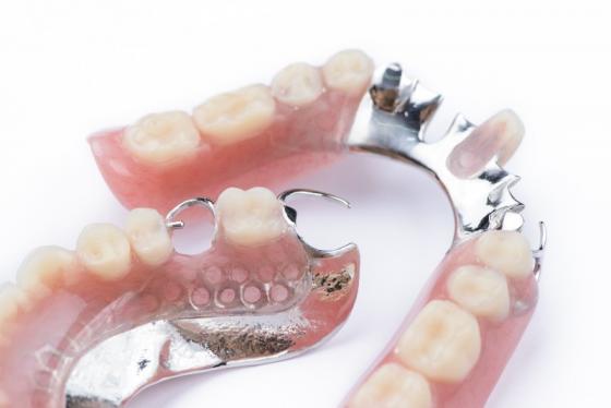 réalisation prothèse dentaire stellite